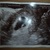 echo 6wk1dg 
