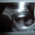 9wk en 1 dg 