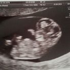 9 weken 6 dagen  Na 2 vroege miskramen nu bijna 10 weken zwanger :)