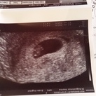  Eerste echo!