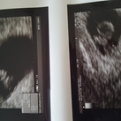 Baby 1e echo en alles was super het hartje klopte perfect!