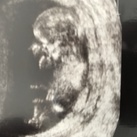 Baby girl  
