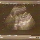  12 weken :) zwanger.... ondertussen alweer 17w3d :)