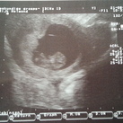 eerste echo! ♥ 