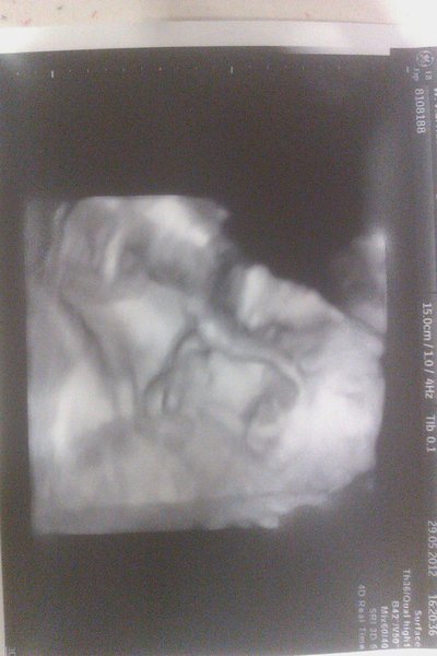 3d echo 27 wk 