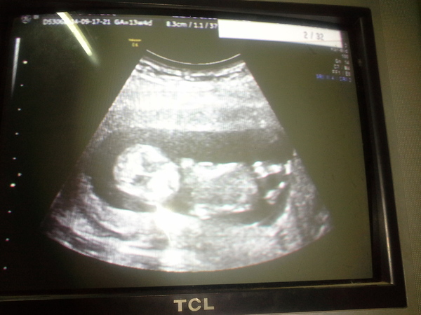 sec.born's eerste echo Eerste echo gemaakt op woensdag 17 september 2014, dat is mij een levendige baby bleef geen moment rustig gelukkig is alles ok 