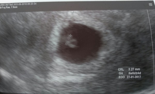 Eerste echo 6w 3d 