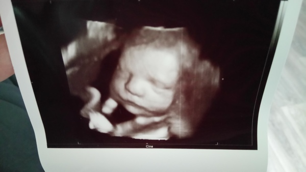 Minime Minime in 3D <3 28+2 wk 