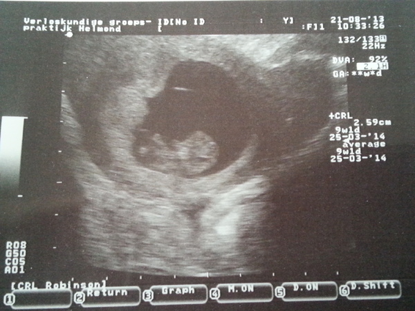 eerste echo! ♥ 