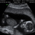 Een zoon 18-1-2012 