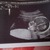 onze frummel 