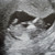 baby verbeek 