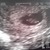 onze frummel in wording :D 