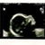 21 weekjes 