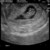ons lieve kleine mini mensje 
