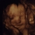 24 weken onze dochter 
