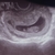 8.5 week e  het hartje gehoord ♡ 