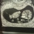 10 weken 6 dagen ♡ 