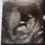 Echo 12w2d 