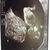 11w5d 