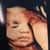  30w5d