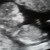  Echo 11,6 wkn