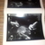 20 week echo 