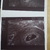 Ons wondertje  6 weken 