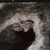 Echo 8 wk 