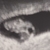 Noot 8 weken 