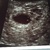 5.5 week 