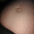 Buikfoto 