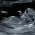 Baby 2019 