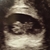 8w6d ♡♡♡