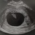 7w4d 