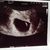  Meet onze frummel <3