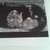 9 weken en 6 dagen ♡♡♡