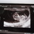 10w5d 
