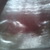 week 17 