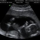 Een zoon 18-1-2012 