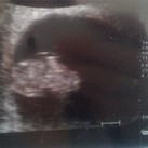  8 weken zwanger, hartje klopt perfect!!