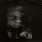 3D echo! 27 weken zwanger 