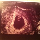  echo 6w 6d