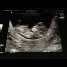  Onze frummel met 11 wk2dg