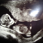 ons wondertje op 11weken in mama's buik