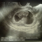 9w6d ♡♥ 
