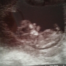 10w5d ♡♥ 