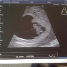 Kloppend hartje :)! 7 weken en 3 dagen Kloppend hartje :)! 7 weken en 3 dagen
