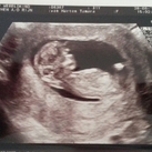 onze kleine spruit 