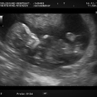 12 weken echo van onze kleine uk 
